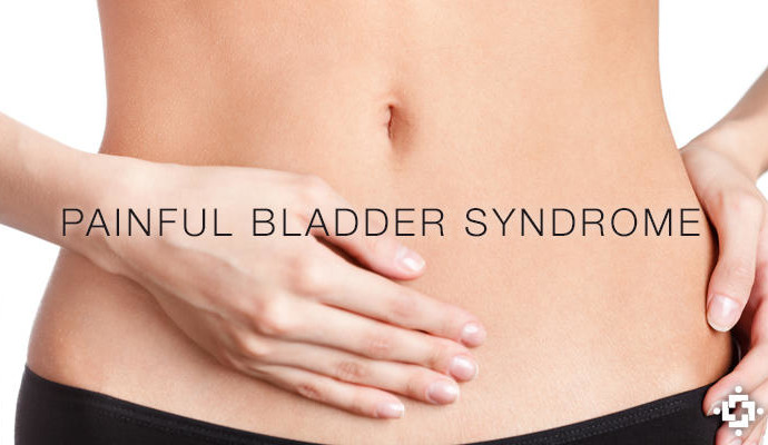 Study: Cannabinoids Treatment for Painful Bladder Syndrome (PBS)