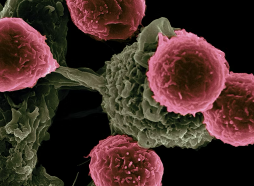 Cannabis Extract Shows Promise in Killing Deadly Skin Cancer Cells